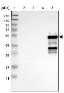 Anti-CYP2C9 antibody produced in rabbit 