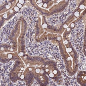 Anti-CYP2R1 antibody produced in rabbit 