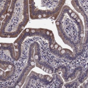 Anti-CYP2S1 antibody produced in rabbit 
