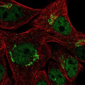 Anti-CYP2U1 antibody produced in rabbit 