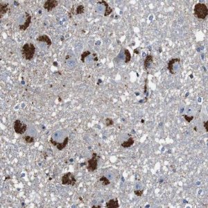 Anti-CYP2W1 antibody produced in rabbit 