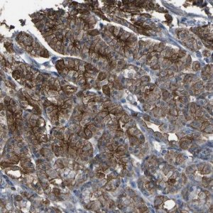 Anti-CYP4F11 antibody produced in rabbit HPA017265-100UL