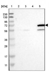 Anti-CYP4F11 antibody produced in rabbit HPA017265-100UL