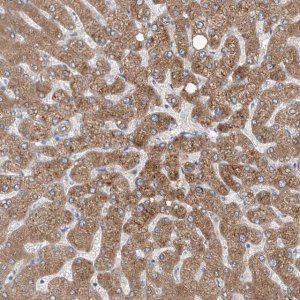 Anti-CYP4V2 antibody produced in rabbit 