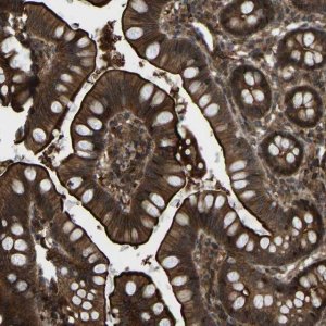 Anti-CYP7B1 antibody produced in rabbit 