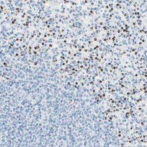 Anti-CYSLTR1 antibody produced in rabbit HPA010546-100UL