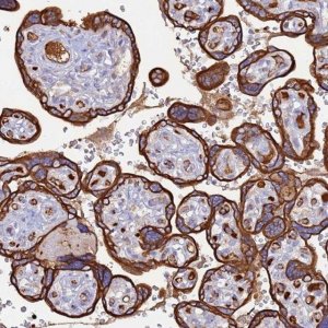 Anti-CYSLTR2 antibody produced in rabbit 