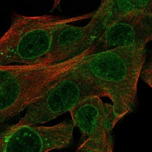 Anti-CYTL1 antibody produced in rabbit 