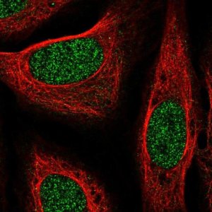 Anti-CYYR1 antibody produced in rabbit 