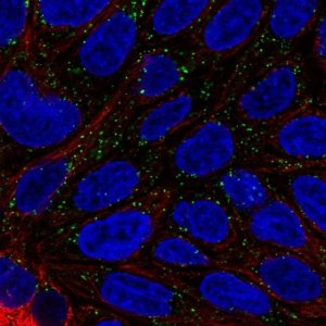 Anti-DAB1 antibody produced in rabbit 
