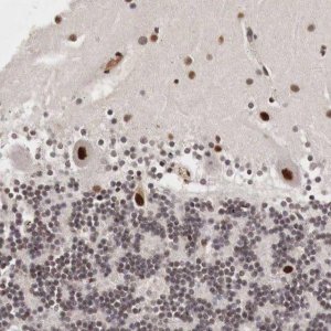 Anti-DACH2 antibody produced in rabbit 