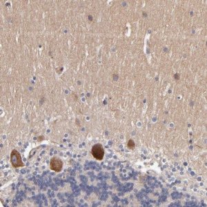 Anti-DACT1 antibody produced in rabbit 