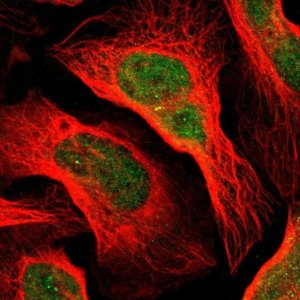 Anti-DACT1 antibody produced in rabbit 