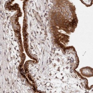 Anti-DACT2 antibody produced in rabbit 