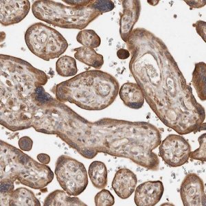 Anti-DACT2 antibody produced in rabbit 