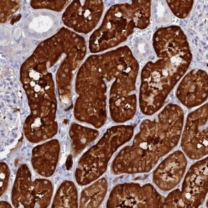 Anti-DACT3 antibody produced in rabbit 