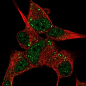 Anti-DACT3 antibody produced in rabbit 
