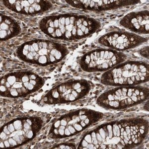 Anti-DALRD3 antibody produced in rabbit 