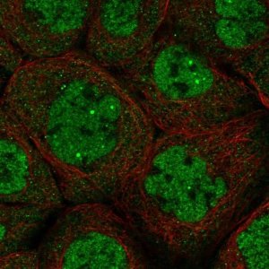 Anti-DALRD3 antibody produced in rabbit 