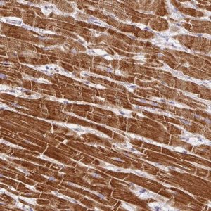Anti-DAPK1 antibody produced in rabbit 