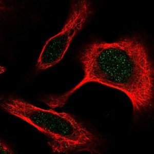 Anti-DAPK3 antibody produced in rabbit 