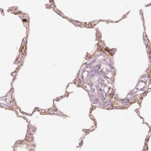 Anti-DAPP1 antibody produced in rabbit 