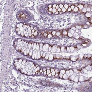 Anti-DBF4B antibody produced in rabbit 