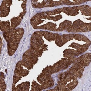 Anti-DBI antibody produced in rabbit 