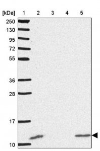 Anti-DBI antibody produced in rabbit 