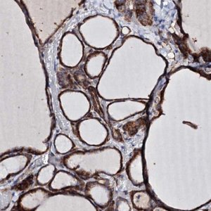 Anti-DBX1 antibody produced in rabbit 
