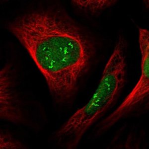 Anti-DCAF1 antibody produced in rabbit 