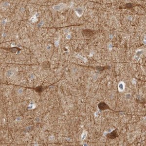 Anti-DCAF10 antibody produced in rabbit 