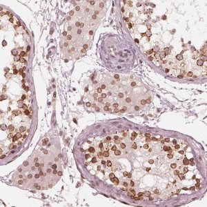 Anti-DCAF12 antibody produced in rabbit 