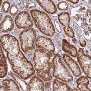 Anti-DCAF12L2 antibody produced in rabbit 