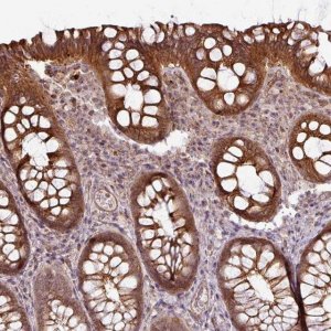 Anti-DCAF13 antibody produced in rabbit 
