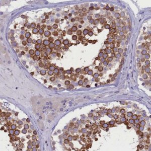 Anti-DCAF16 antibody produced in rabbit 