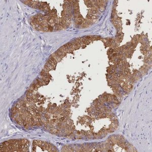 Anti-DCAF16 antibody produced in rabbit 