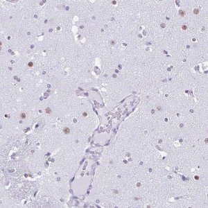 Anti-DCAF17 antibody produced in rabbit 