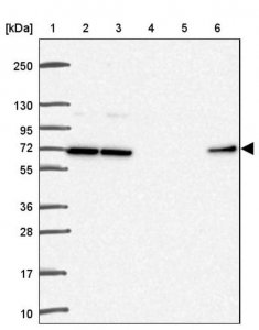 Anti-DCAF17 antibody produced in rabbit 