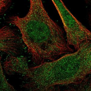 Anti-DCAF6 antibody produced in rabbit 