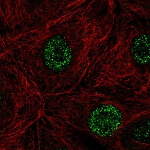 Anti-DCAKD antibody produced in rabbit 