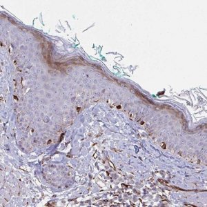 Anti-DCBLD1 antibody produced in rabbit 