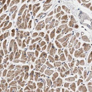 Anti-DCBLD2 antibody produced in rabbit 