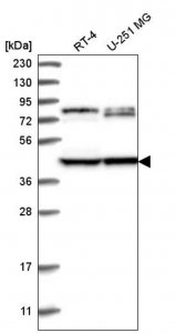 Anti-DCDC2 antibody produced in rabbit 