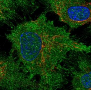Anti-DCHS1 antibody produced in rabbit 