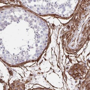 Anti-DCHS2 antibody produced in rabbit 