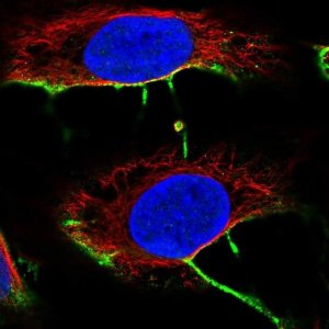 Anti-DCHS2 antibody produced in rabbit 