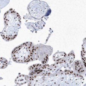 Anti-DCLRE1A antibody produced in rabbit 