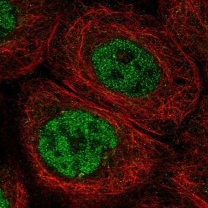 Anti-DCLRE1C antibody produced in rabbit 