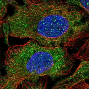 Anti-DCP1B antibody produced in rabbit 